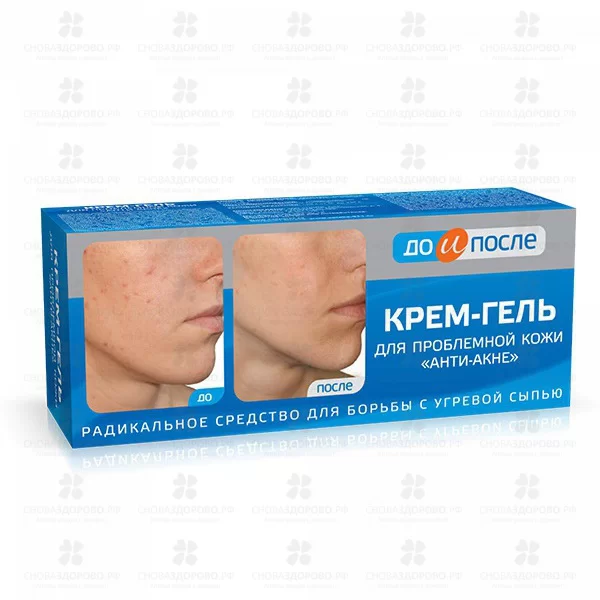 До и После Анти-Акне Крем-гель для проблемной кожи 50мл ✅ 37804/06898 | Сноваздорово.рф