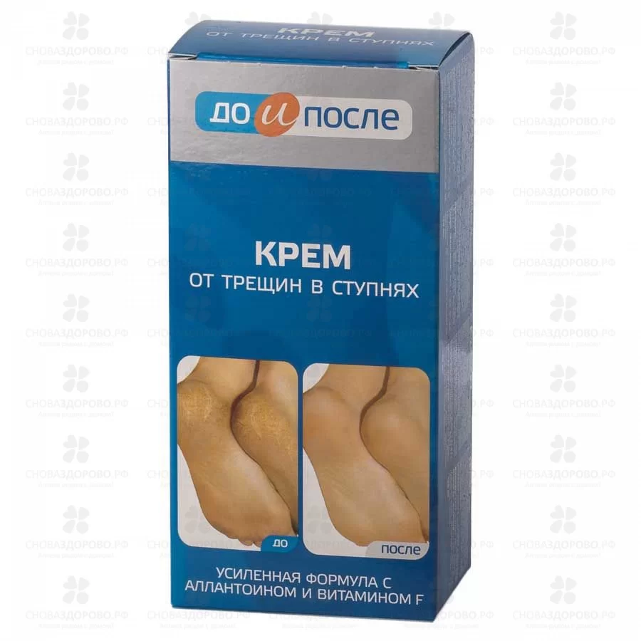 До и После крем от трещин в ступнях 150мл ✅ 29007/06898 | Сноваздорово.рф